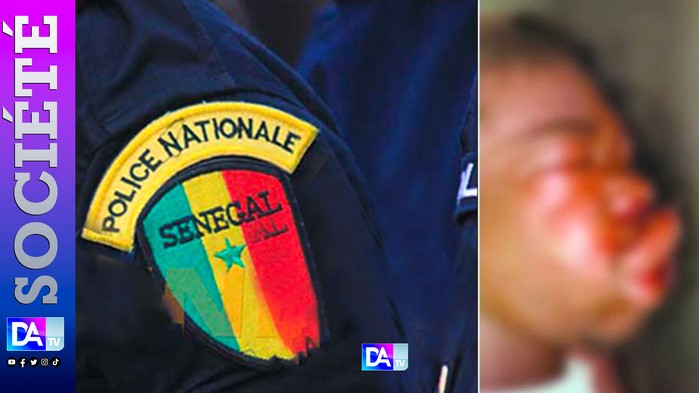 Sénégal retour aux vieilles pratiques -quand une certaine police frappe- cogne et donne la mort-mort atroce de Adama Keita-ROSSO-Stop